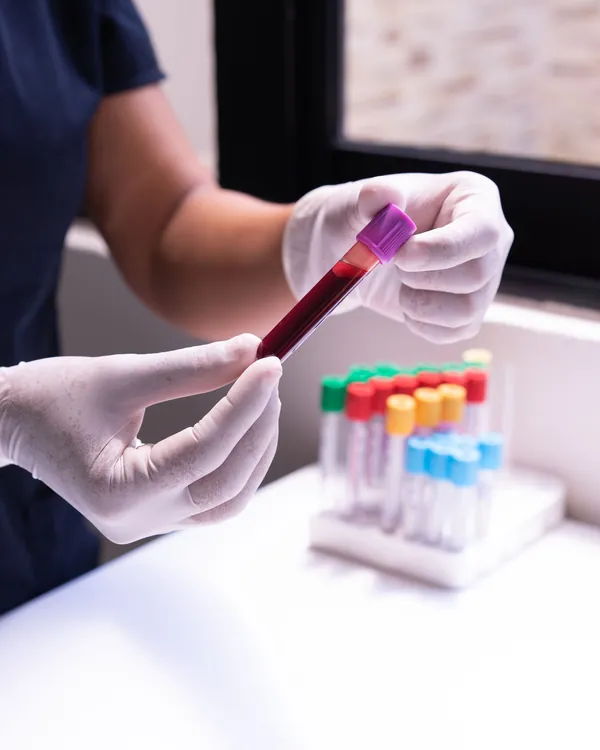 Profissional de laboratório analisando amostras